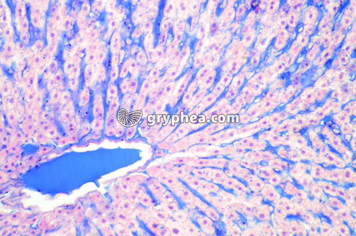 Foie injecté montrant les capillaires sanguins (sinusoïdes hépatiques) x40 - gryphea.org